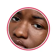 آموزش چهره سیاه پوست(بافت تخصصی)